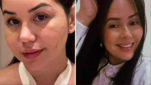 Esposa de sertanejo apanha da ex e diz temer pela própria vida e pela do marido